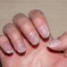 Damaged Nails After Removal? Why It Happens and 7 Tips to Repair Them